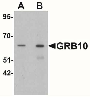 Western Blot: GRB10 AntibodyBSA Free [NBP2-41159]