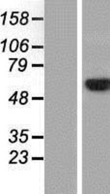 Western Blot: GRB10 Overexpression Lysate [NBP2-08984]