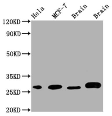 Western Blot: GRB2 Antibody (6E1) [NBP3-15167]