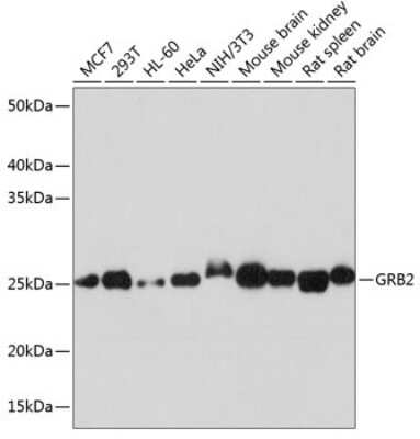 Western Blot: GRB2 Antibody (9K6H0) [NBP3-15638]