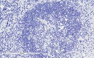 Immunohistochemistry-Paraffin: GRB2 Antibody [NB100-866]