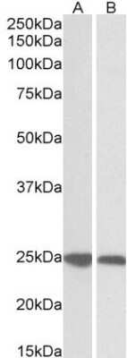 Western Blot: GRB2 Antibody [NB100-866]