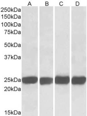 Western Blot: GRB2 Antibody [NB100-866]