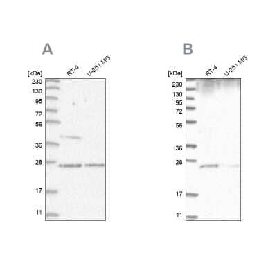 Western Blot: GRB2 Antibody [NBP2-55208]