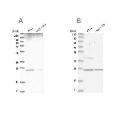 Western Blot: GRB2 Antibody [NBP2-55209]