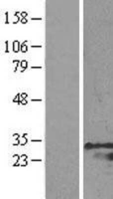 Western Blot: GRB2 Overexpression Lysate [NBL1-11326]