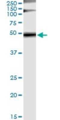 Immunoprecipitation: GRB7 Antibody (3C12) [H00002886-M03]