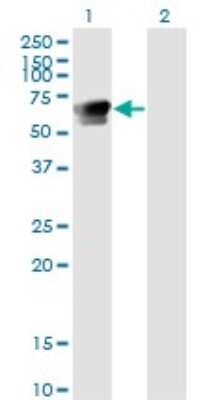 Western Blot: GRB7 Antibody (3C12) [H00002886-M03]