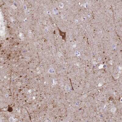 Immunohistochemistry: GRB7 Antibody [NBP2-49243]