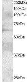 Western Blot: GRB7 Antibody [NB100-1027]