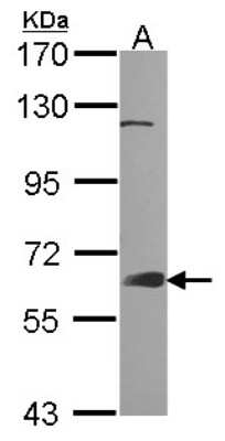 Western Blot: GRB7 Antibody [NBP1-30964]