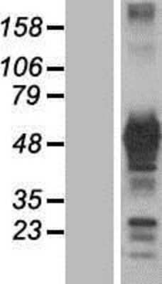 Western Blot: GRB7 Overexpression Lysate [NBP2-08604]