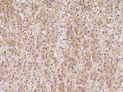 Immunohistochemistry-Paraffin: GRCC10 Antibody [NBP2-97383]