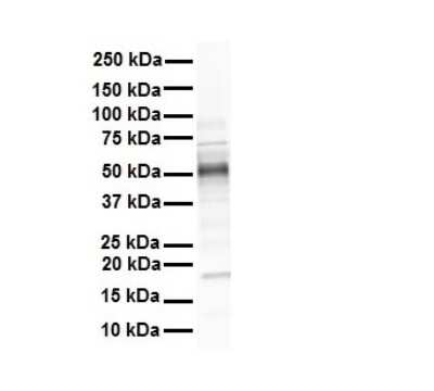 Western Blot: GREB1 Antibody [NBP3-10496]