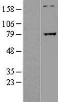 Western Blot: GREB1 Overexpression Lysate [NBL1-11329]