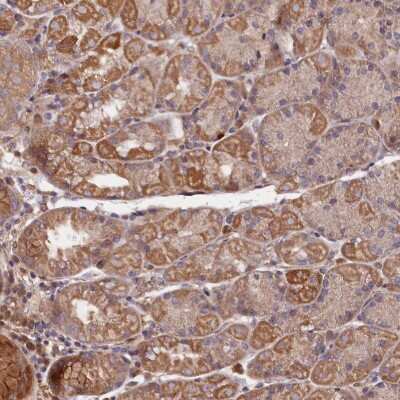 Immunohistochemistry-Paraffin: GREB1L Antibody [NBP2-32595]