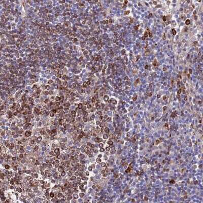 Immunohistochemistry-Paraffin: GREB1L Antibody [NBP2-33415]
