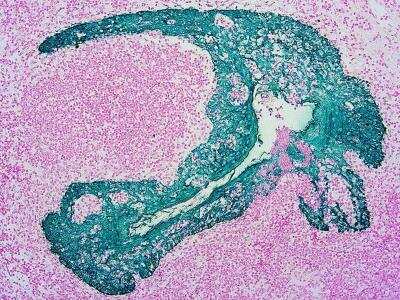 Immunohistochemistry-Paraffin: GREEN HRP Staining Kit (Colorimetric) [NBP3-12181]