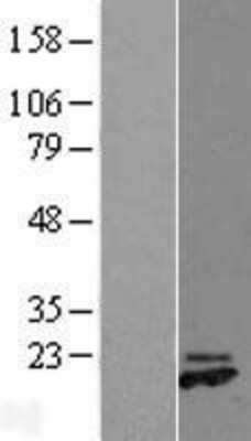 Western Blot: PRDC/GREM2 Overexpression Lysate [NBL1-11330]