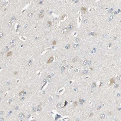 Immunohistochemistry-Paraffin: GRF2 Antibody [NBP1-88266]