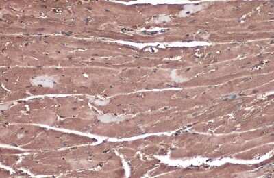 Immunohistochemistry-Paraffin: GRF2 Antibody [NBP3-13284]