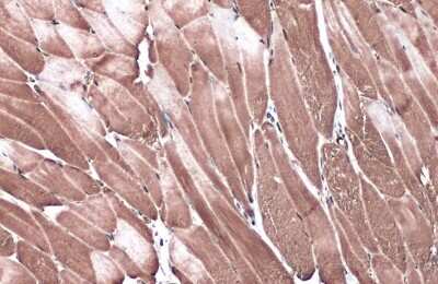 Immunohistochemistry-Paraffin: GRF2 Antibody [NBP3-13284]