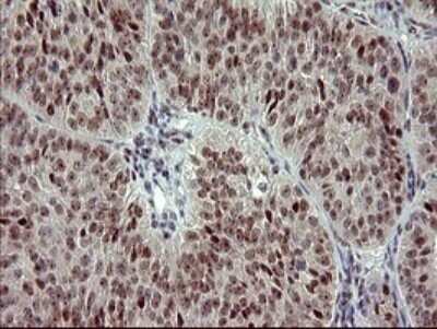 Immunohistochemistry: GRF2 Antibody (OTI2F5) - Azide and BSA Free [NBP2-70846]