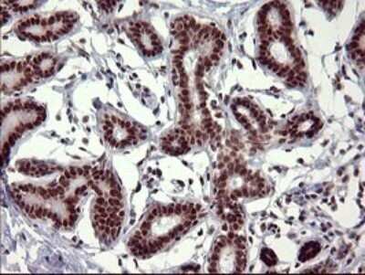 Immunohistochemistry: GRF2 Antibody (OTI2F5) - Azide and BSA Free [NBP2-70846]