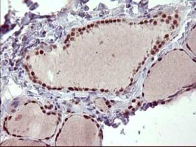 Immunohistochemistry: GRF2 Antibody (OTI2F5) - Azide and BSA Free [NBP2-70846]