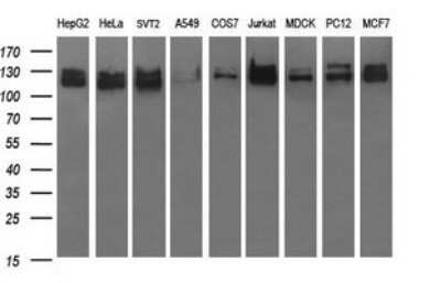 Western Blot: GRF2 Antibody (OTI2F5)Azide and BSA Free [NBP2-70846]