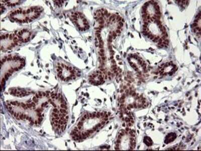 Immunohistochemistry: GRF2 Antibody (OTI2F5) [NBP2-45515]