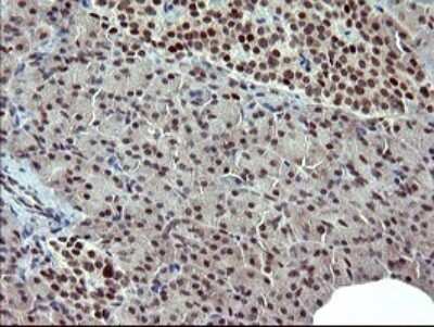 Immunohistochemistry: GRF2 Antibody (OTI2F5) [NBP2-45515]