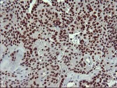 Immunohistochemistry: GRF2 Antibody (OTI2F5) [NBP2-45515]
