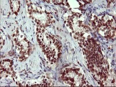 Immunohistochemistry: GRF2 Antibody (OTI2F5) [NBP2-45515]