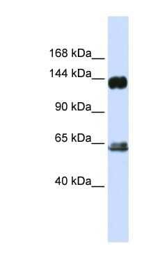 Western Blot: GRF2 Antibody [NBP1-58306]