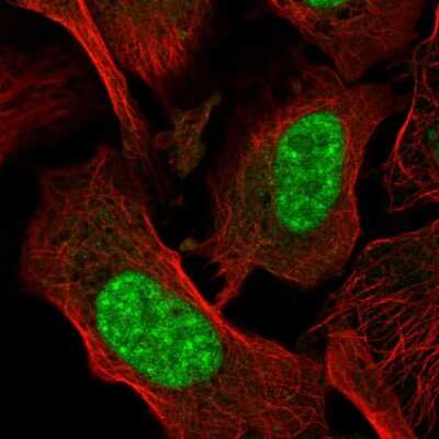 Immunocytochemistry/ Immunofluorescence: GRG (Groucho homolog) Antibody [NBP2-58543]