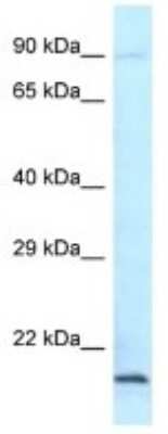 Western Blot: GRG (Groucho homolog) Antibody [NBP3-10455]