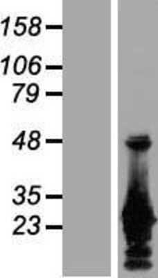 Western Blot: GRG (Groucho homolog) Overexpression Lysate [NBP2-10957]