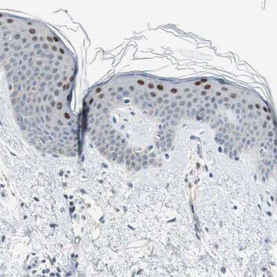 Immunohistochemistry-Paraffin: GRHL1 Antibody [NBP1-81322]