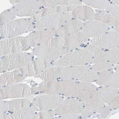 Immunohistochemistry-Paraffin: GRHL1 Antibody [NBP1-81322]
