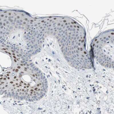 Immunohistochemistry-Paraffin: GRHL1 Antibody [NBP1-81322]