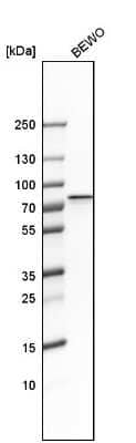 Western Blot: GRHL1 Antibody [NBP1-81321]