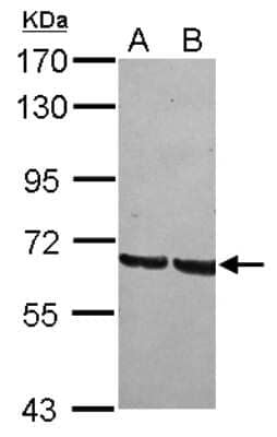 Western Blot: GRHL1 Antibody [NBP2-16743]