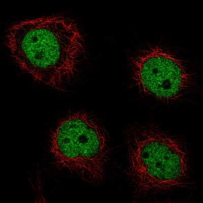 Immunocytochemistry/ Immunofluorescence: GRHL2 Antibody (CL3760) [NBP2-61634]