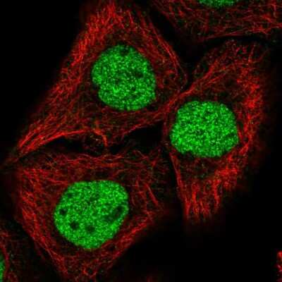 Immunocytochemistry/ Immunofluorescence: GRHL2 Antibody [NBP2-56852]