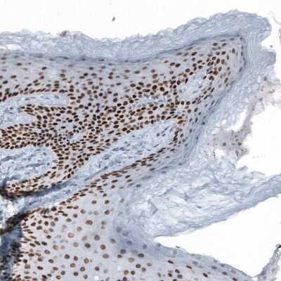 Immunohistochemistry-Paraffin: GRHL2 Antibody [NBP1-88552]