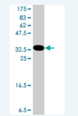 Western Blot: GRHL2 Antibody [H00079977-A01]