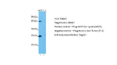 Western Blot: GRHL2 Antibody [NBP1-80369]