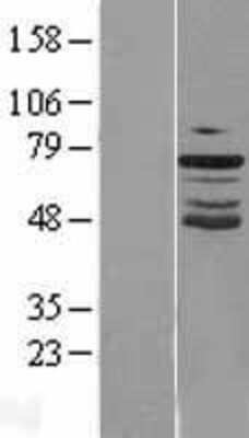 Western Blot: GRHL2 Overexpression Lysate [NBL1-11332]