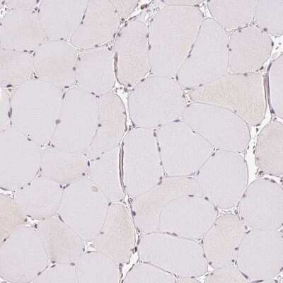 Immunohistochemistry-Paraffin: GRHL3 Antibody [NBP2-57087]